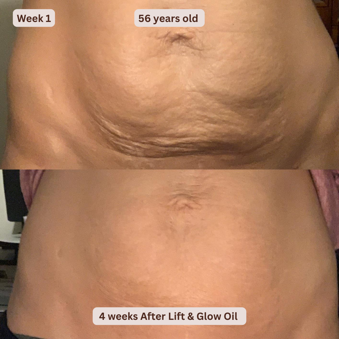 Lift & Glow Cellulite Body Oil